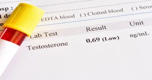 The Benefits of Testosterone Replacement Therapy