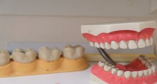 Do dentures hurt? An ideal, affordable, and effective way to replace missing teeth, click here to explore more about the denture implant process.